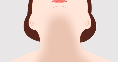 이중턱 상태에 따라 수술 디자인을 결정하는 과정