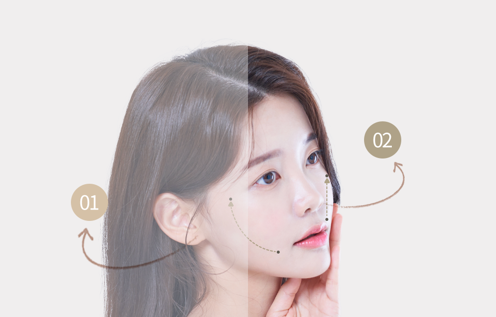 기존 사선 방향 리프팅과 올하트 수직 방향 리프팅의 당김 방향을 비교한 얼굴 이미지