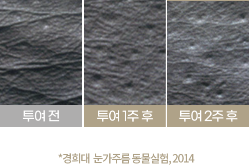 리쥬란힐러 시술 후 얼굴 피부 탄력과 눈가 주름 개선 결과 자료