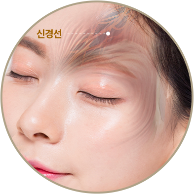 이마거상술에서 신경선의 위치와 주행을 보여주는 얼굴 해부학 이미지