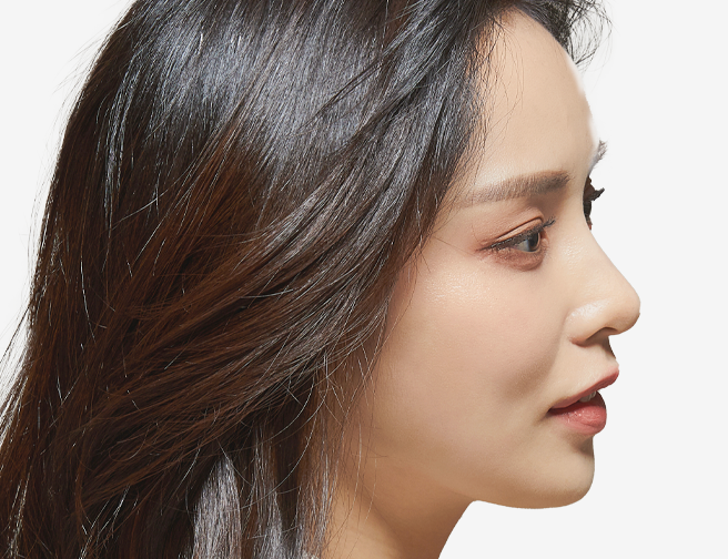 수술 방법 안내 이미지