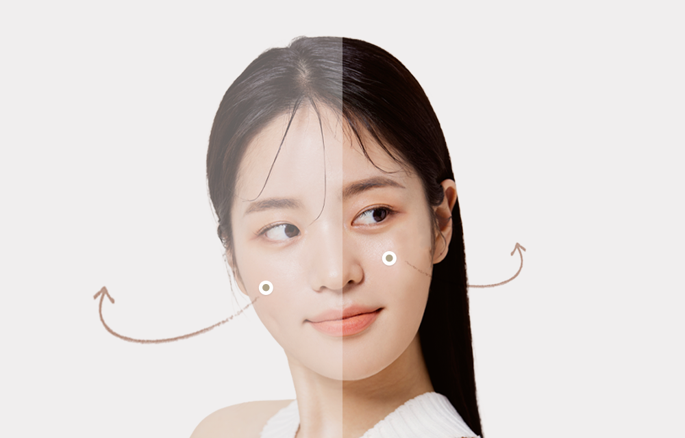 과절제 시 뼈가 제대로 붙지 않아 불유합이 발생