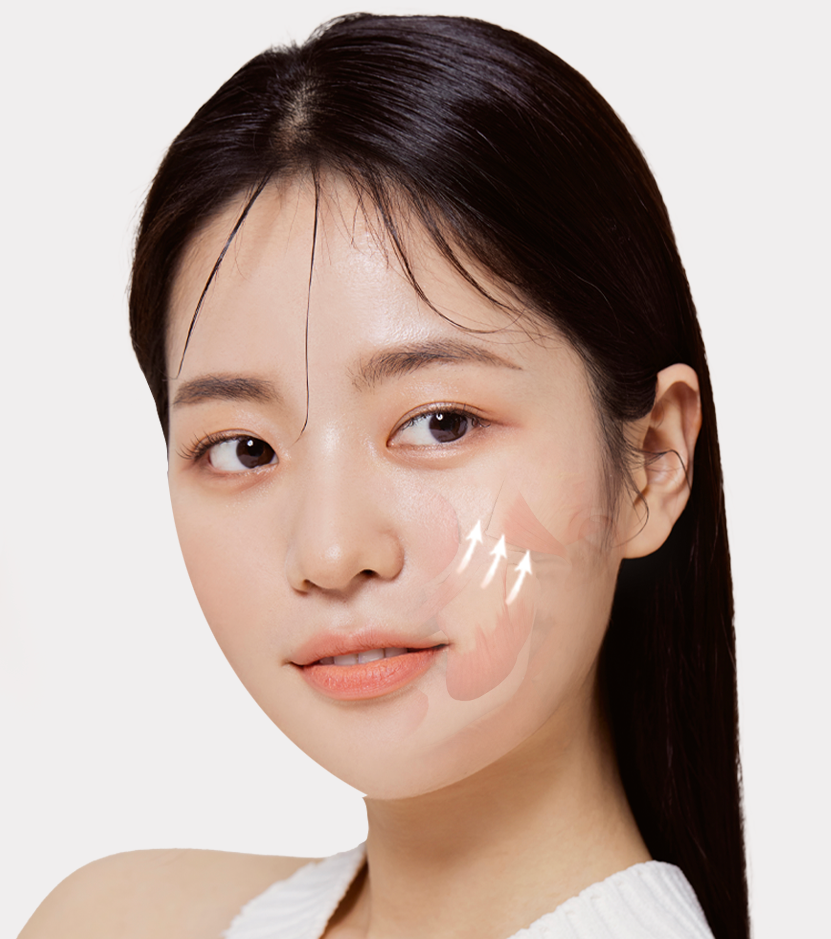 광대 심부볼 지방제거를 설명하는 이미지