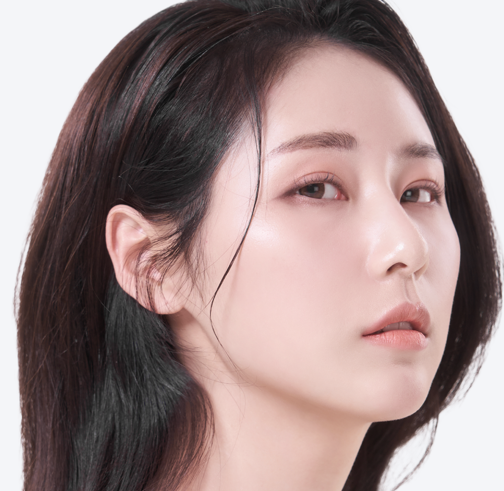 성형 시술 대상 안내 이미지