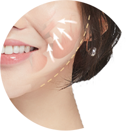 교근 축소 부위 이미지