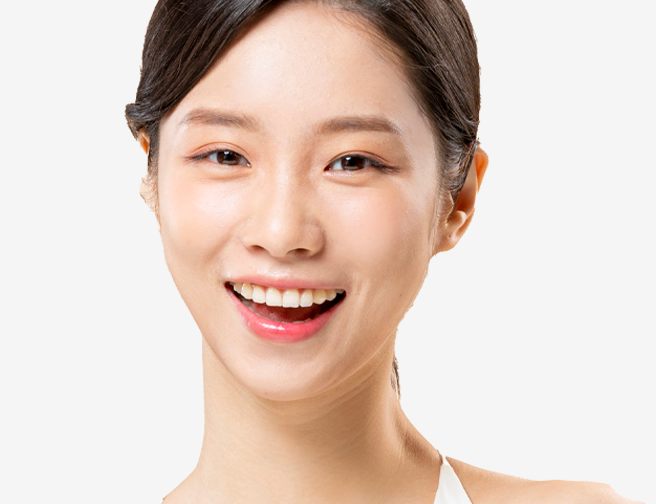 턱끝성형 안내 이미지