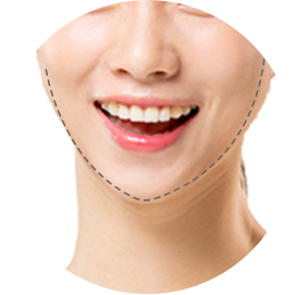 앞턱의 폭과 비율, 얼굴 전체를 고려 이미지