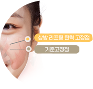 광대뼈와 연결된 근육 골막과 지방, 피부를 모두 팽팽하게 이미지