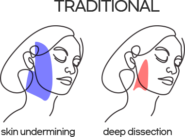 tranditional image