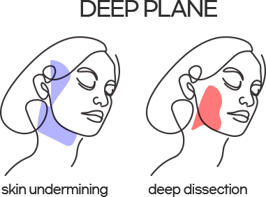 deep plane image